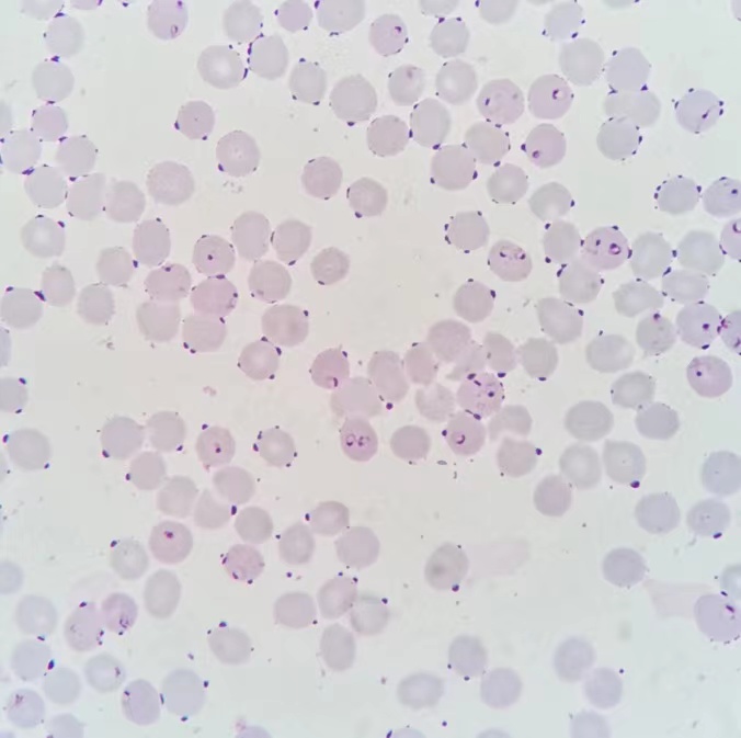 图为恶性疟环状体